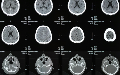 The Magnetic Power of the Future: The Iseult CEA 11.7 T MRI