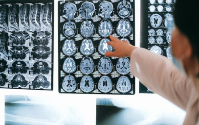 International Stroke Conference 2026